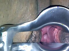 Fat Harige Zwarte Latin Pussy Speculum Play